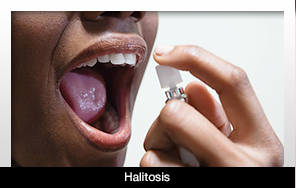 Dentists May be Able to Detect Levels of Halitosis