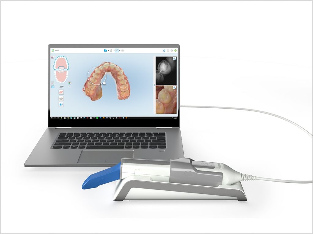 ITero Element 5D Named Best New Technology Dentistry Today