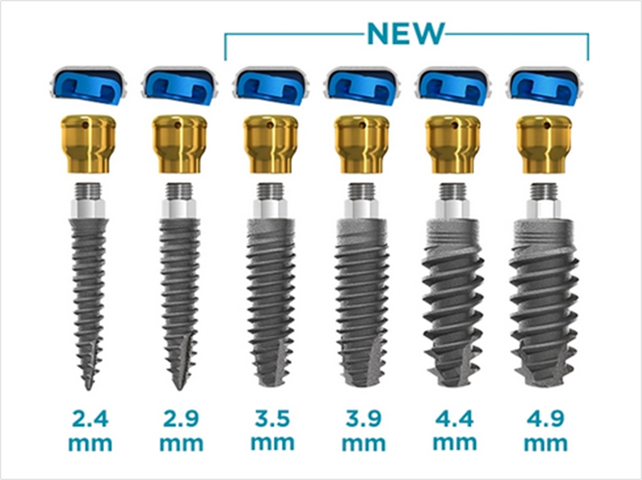 Implant Lineup Expands To Include Range Of Diameters Dentistry Today