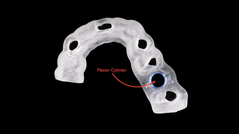 A Comprehensive Classification System For Dental Implant Surgical