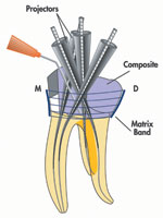 Endodontics From Access to Success, Part 1 Access, The Important First ...