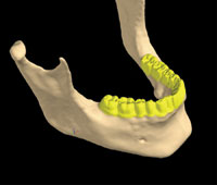 Virtual Diagnostics Using Cone Beam CT - Dentistry Today