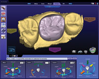 The Evolution Of Digital Dentistry And The Digital Dental Team ...