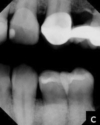 Maximum Results With Minimal Preps - Dentistry Today