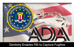 Dentistry Enables FBI to Capture Fugitive - Dentistry Today