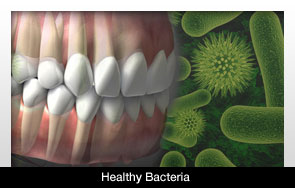 Healthy Bacteria May be Tied to Gum Disease – Dentistry Today