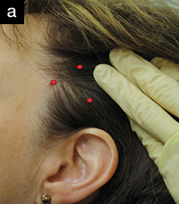 Differential Diagnosis of Toothache Pain: Part 2, Nonodontogenic ...