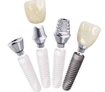 Garrison Dental Solutions – Matrix Band – Dentistry Today