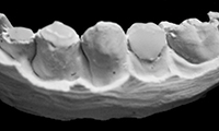 Role for CAD/CAM in Forensics? - Dentistry Today