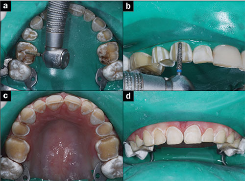 Predictable Cosmetic and Restorative Dentistry - Dentistry Today