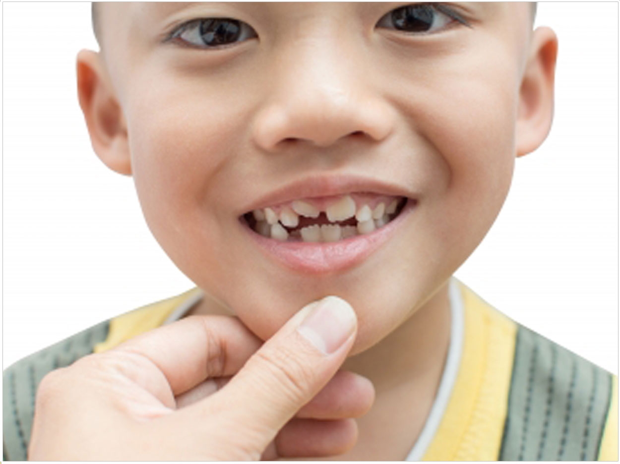 Pediatricians to Apply Fluoride Varnish in New Program - Dentistry Today