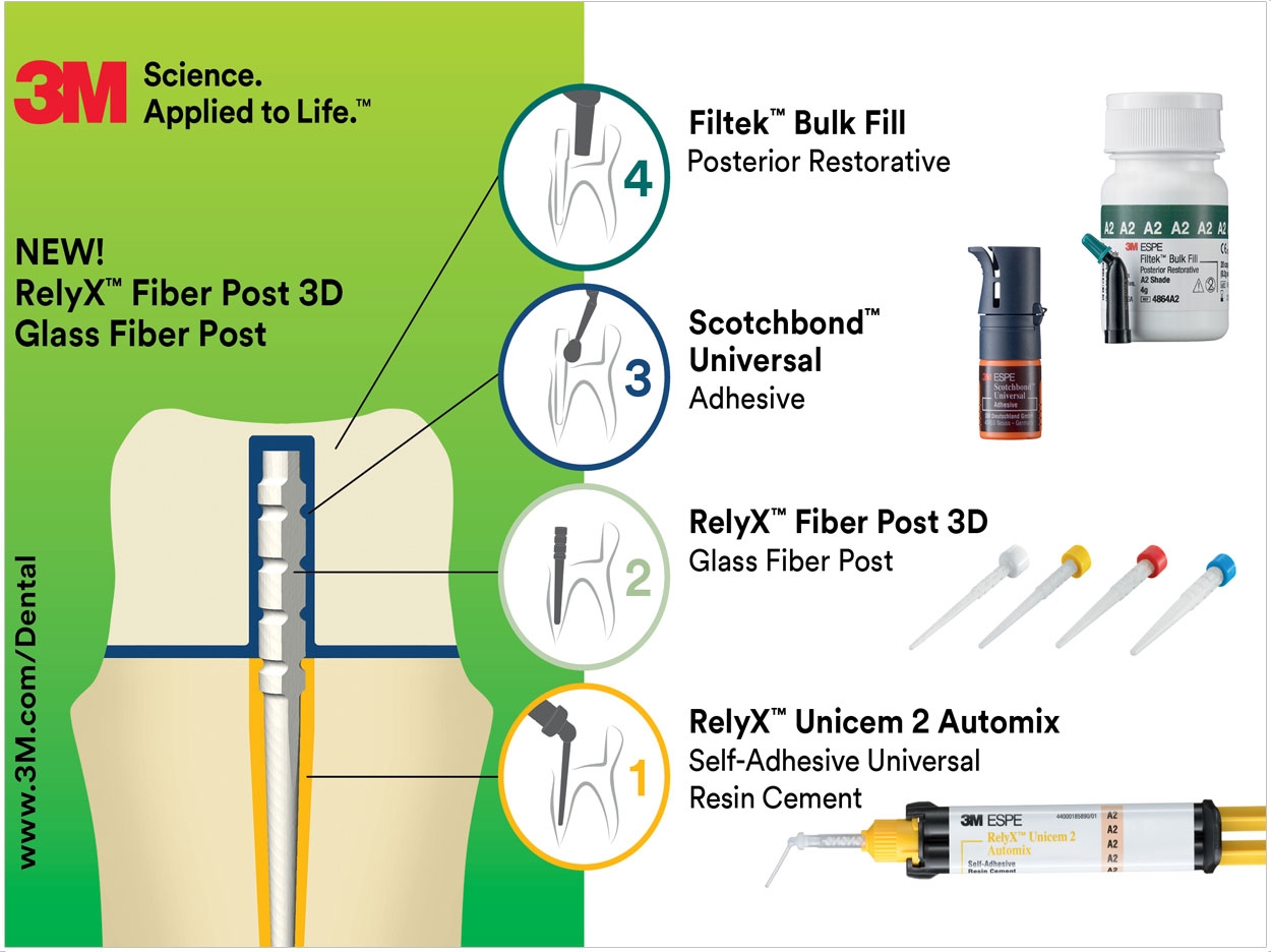 Types Of Post In Endodontics at Edith Estes blog