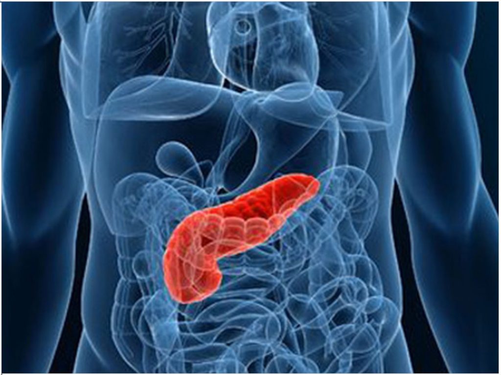 Pancreatic Cancer Risk Linked To Specific Oral Bacteria Dentistry Today