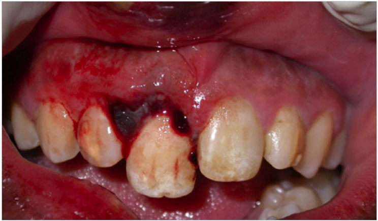 Facts About Child Dental Trauma amp Injury You Must Know