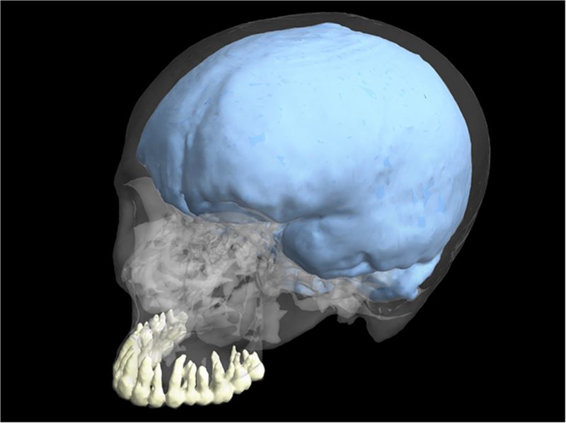 Bigger Brains Did Not Lead To Smaller Teeth In Human Evolution ...