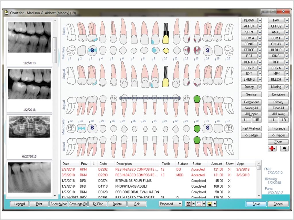 Software Update Streamlines and Simplifies Daily Processes - Dentistry ...