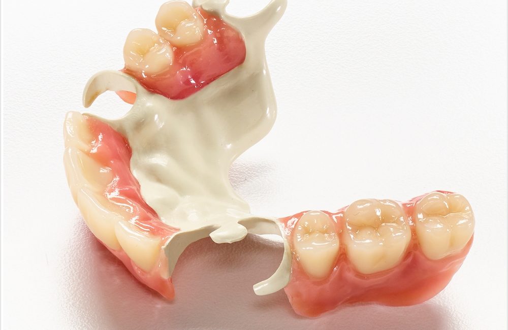 RPD Polymer Validated for CAD/CAM Workflows - Dentistry Today