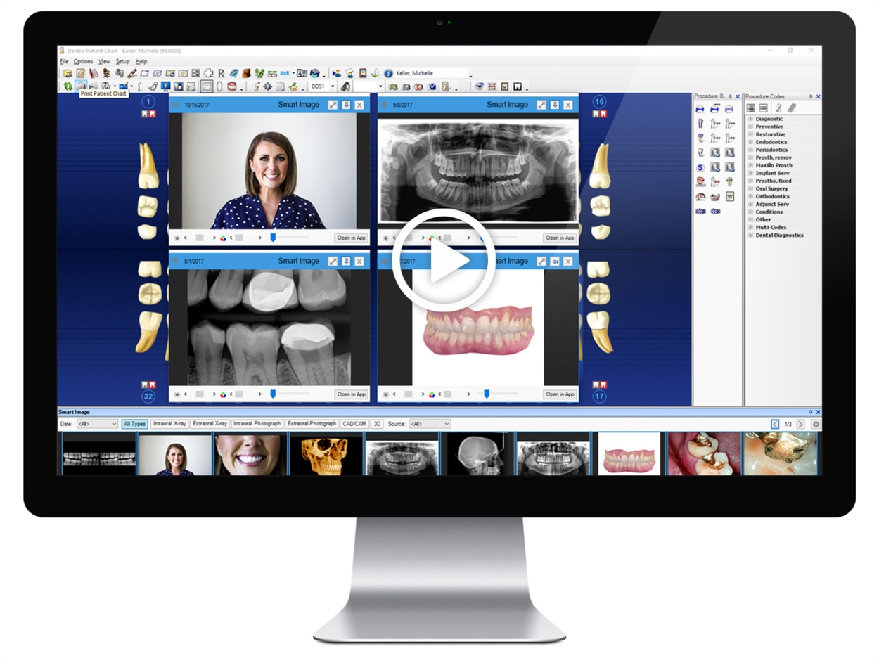 dentrix-g7-upgrade-integrates-patient-charts-with-imaging-solutions