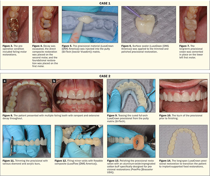 chairside-fabricated-long-term-provisional-restorations-dentistry-today