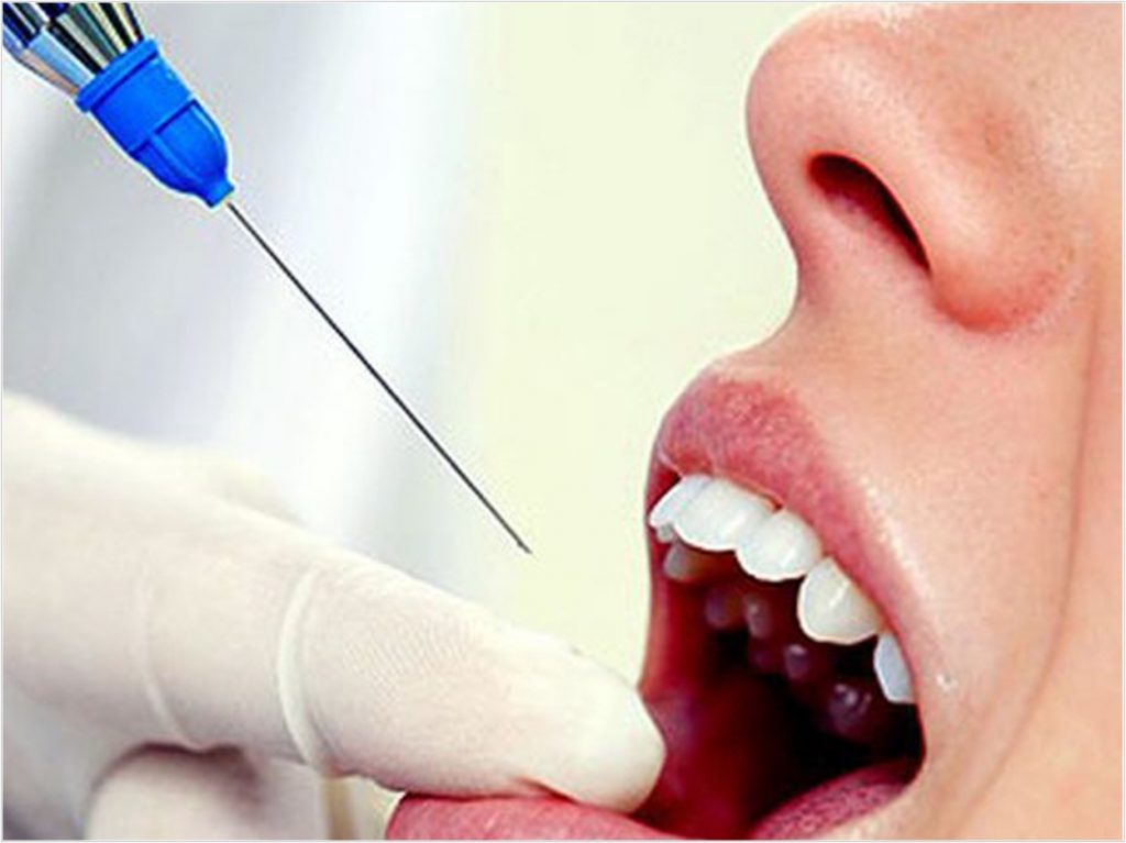Dentists License Suspended On Charges Of Excessive Anesthetics Dentistry Today 5209