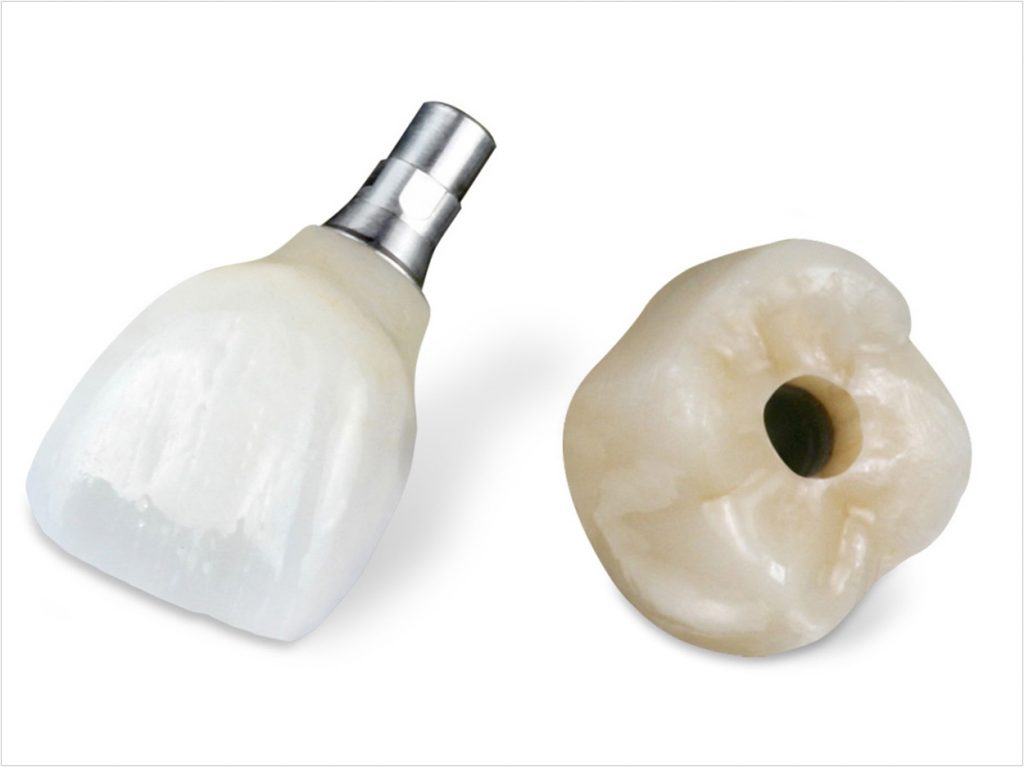 DenMat Introduces Implant Services - Dentistry Today