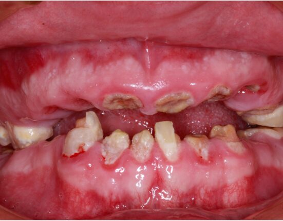 Photo by Dr. Richard Winter; https://www.dentistrytoday.com/articles/10549