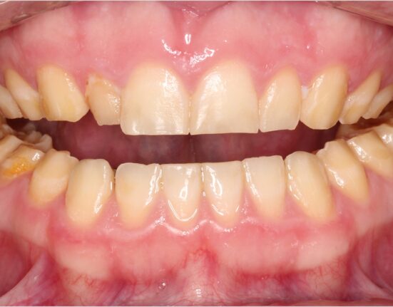 Photo by Dr. Tyler Wynne; dentistrytoday.com/articles/10497