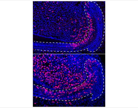 Image courtesy Ophir Klein, UCSF