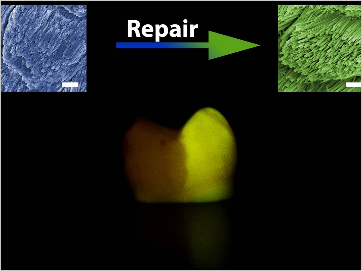 tooth enamel regeneration