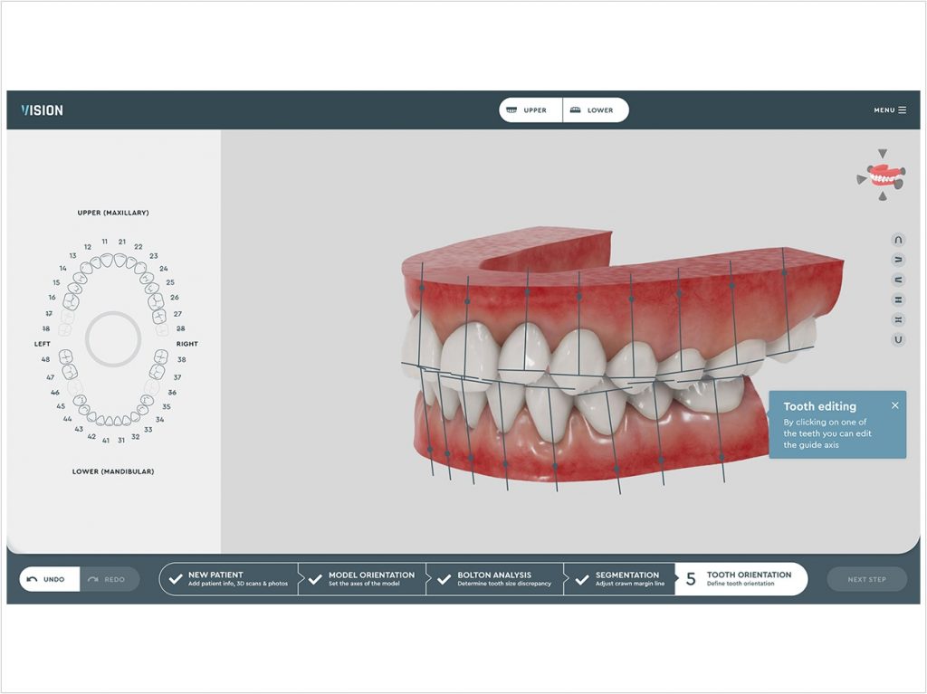 Software Platform Enables Clear Aligner Treatment Dentistry Today