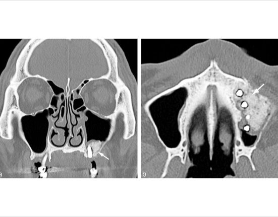 Courtesy of the Journal of Oral Implantology.