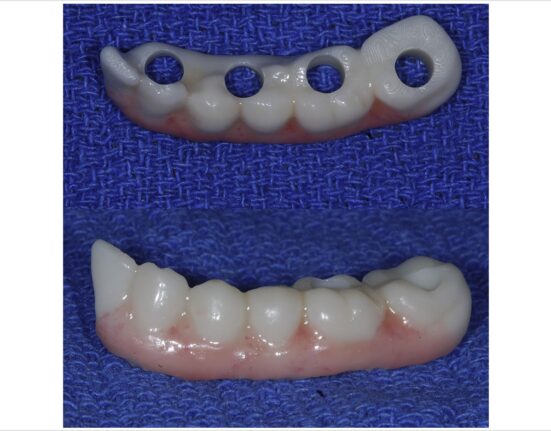 Photo courtesy of the Journal of Oral and Maxillofacial Surgery.