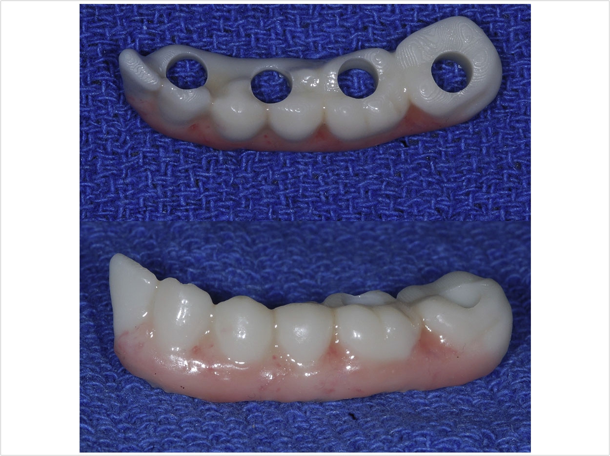 Photo courtesy of the Journal of Oral and Maxillofacial Surgery.