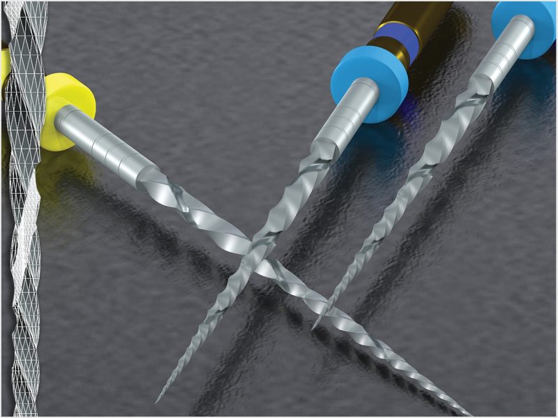 Essential Dental Systems Safesiders Hf Endodontic Instruments Dentistry Today