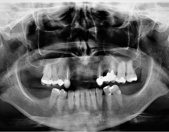 Courtesy of the Journal of Oral Implantology