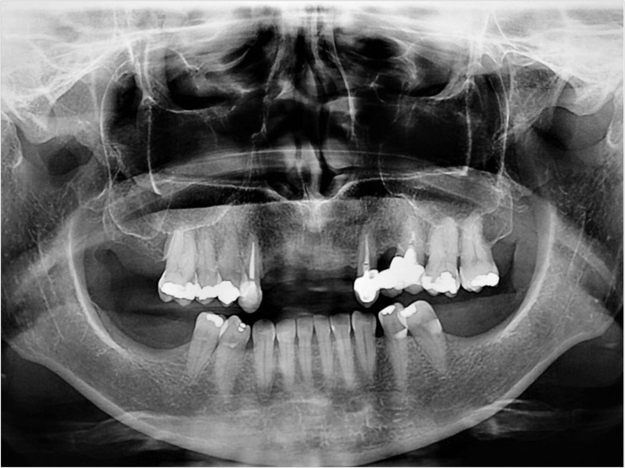 Courtesy of the Journal of Oral Implantology