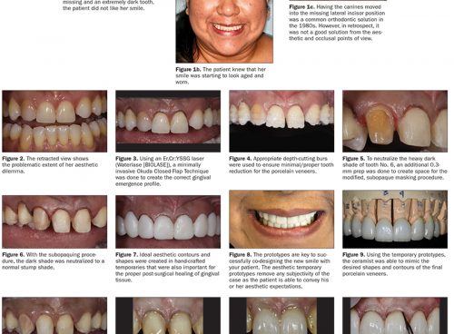 Articles Magazine - Aesthetics Aesthetics - Page 3 of 33 - Dentistry Today