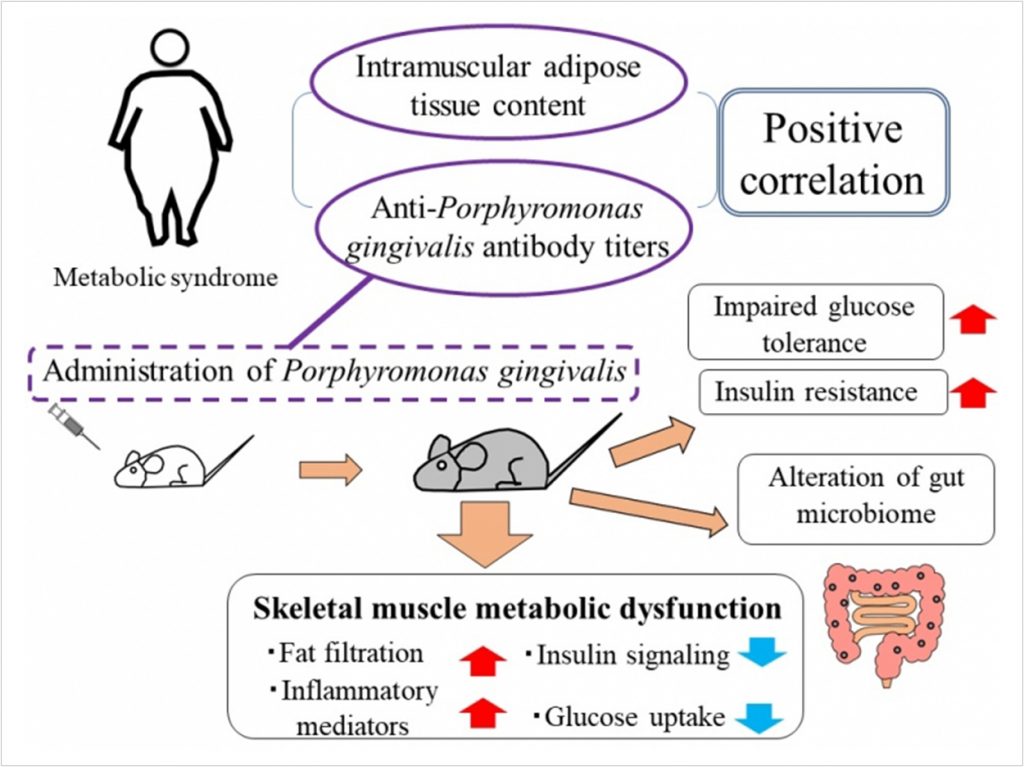 Poor Oral Hygiene May Lead To Metabolic Syndrome - Dentistry Today