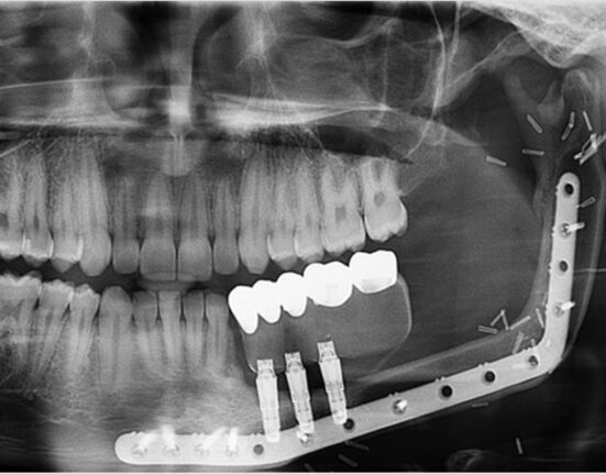 Courtesy of the Journal of Oral and Maxillofacial Surgery.