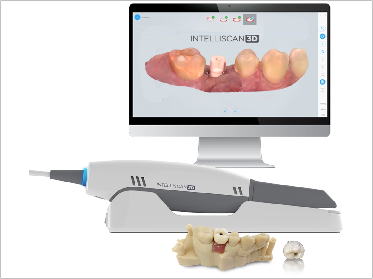 Intraoral Scanner Designed For Easy Use Dentistry Today