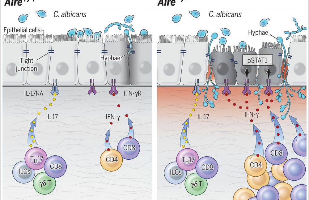 Researchers Uncover How Fungus Takes Hold in the Oral Cavity ...