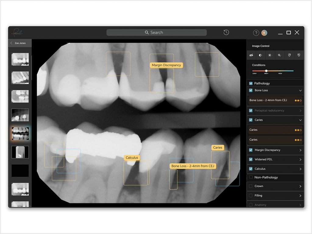 Dental Pathology Detection Technology Gets CE Certification Dentistry Today