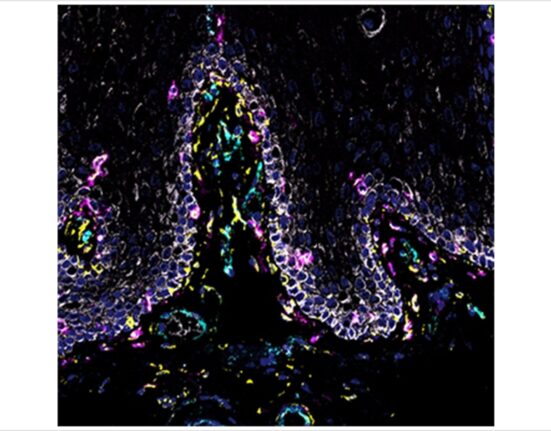 Drake Williams, DDS, PhD, Moutsopoulos Lab