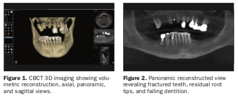 autologous tooth structure