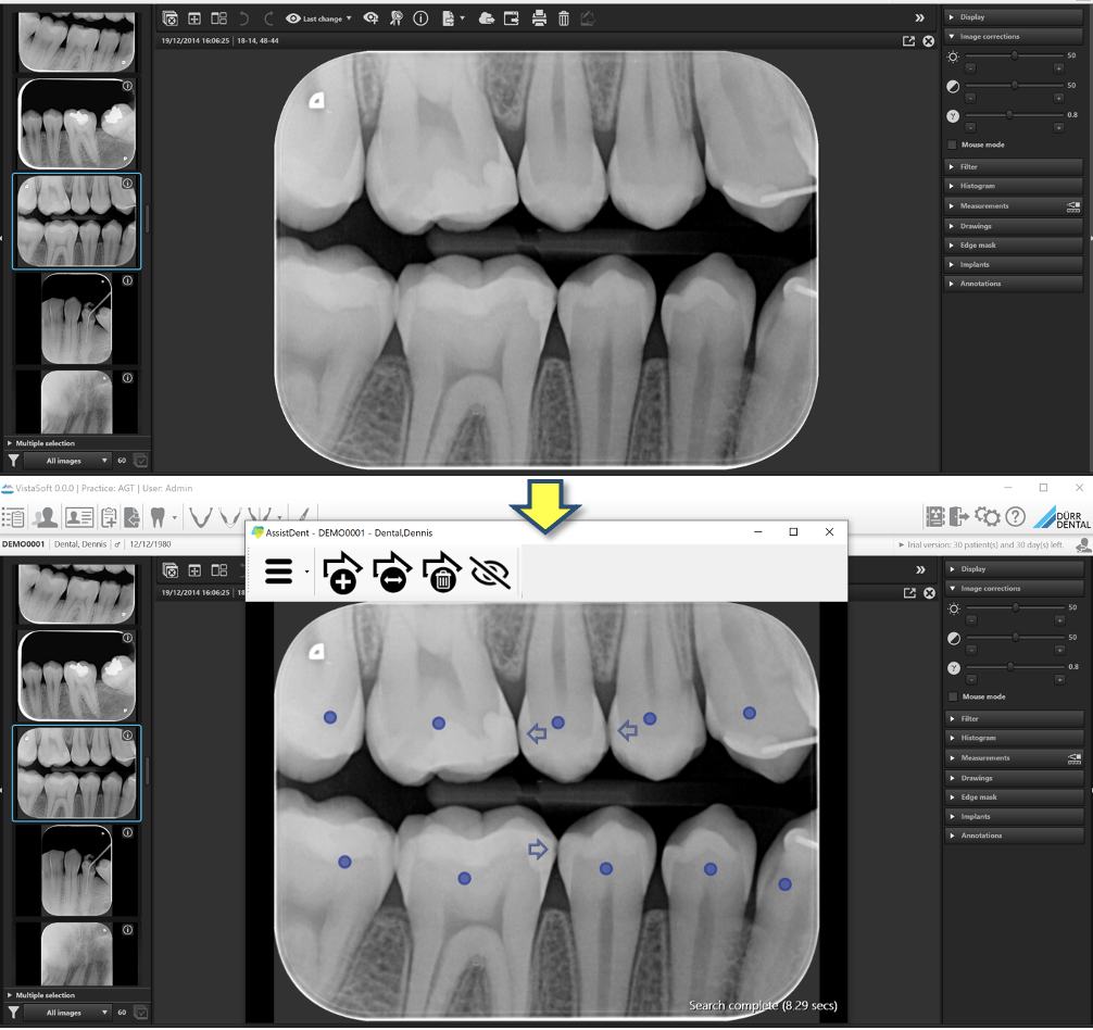 ADEPT Study Proves the Benefits of AI Technology for Dentistry