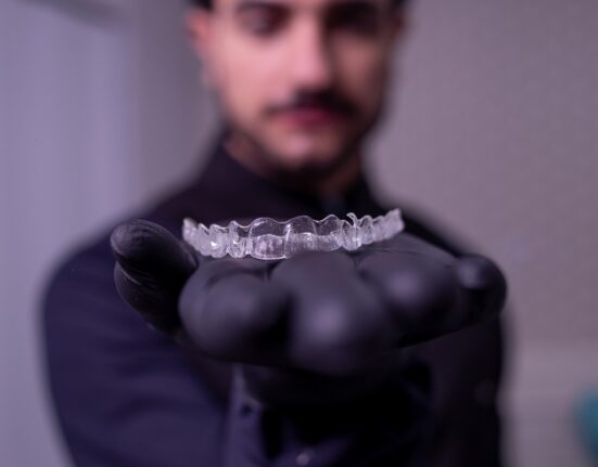 clear aligners