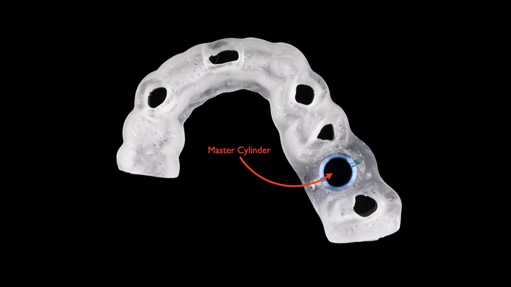 A Comprehensive Classification System For Dental Implant Surgical ...