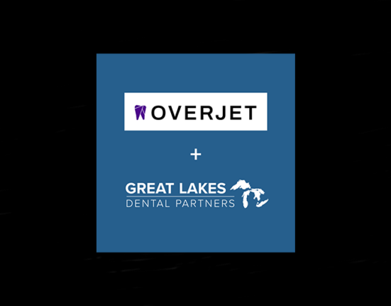 overjet