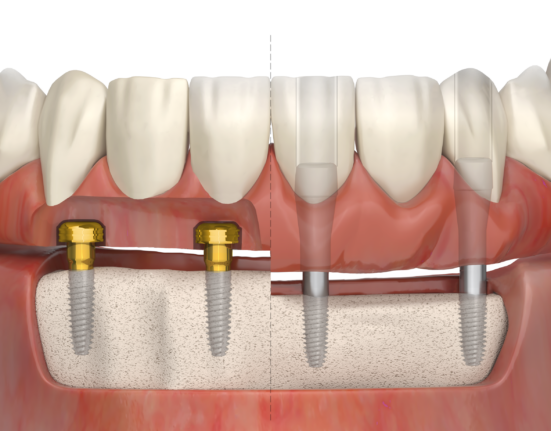 zest dental solutions