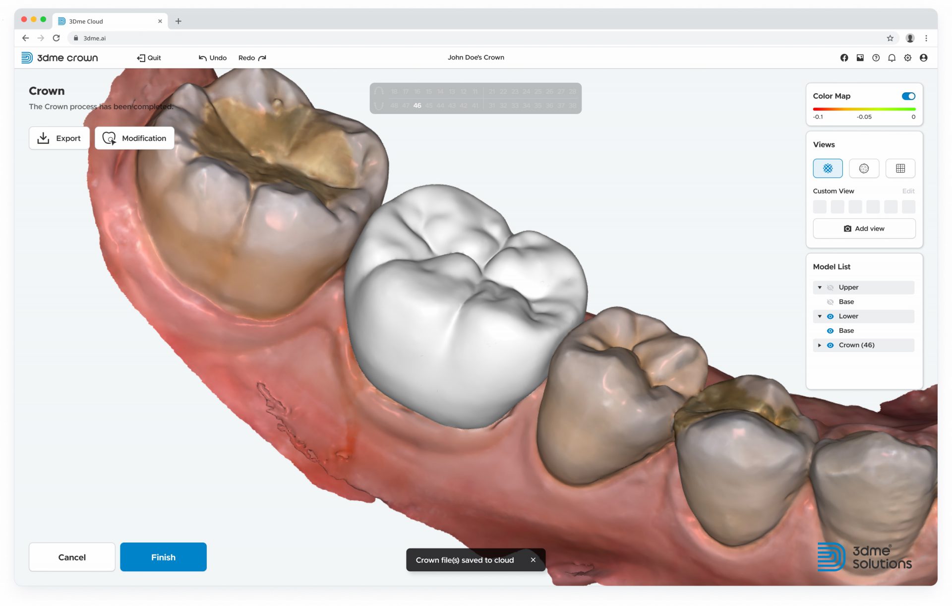 Imagoworks Launches AI-Based Web Dental CAD 3Dme Crown